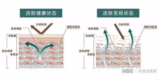不同气候环境下的护肤策略调整：干燥、潮湿、污染与高原