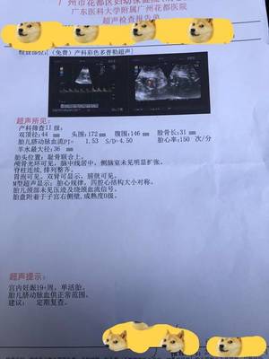 孕期关键产检项目时间表：NT、唐筛、大排畸、糖耐一次看懂